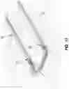 Fig. 08 - METHOD AND APPARATUS FOR MANIPULATING THE SIDE WALL OF A BODY LUMEN OR BODY CAVITY SO AS TO PROVIDE INCREASED VISUALIZATION OF THE SAME AND/OR INCREASED ACCESS TO THE SAME, AND/OR FOR STABILIZING INSTRUMENTS RELATIVE TO THE SAME