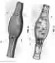 Fig. 37 - METHOD AND APPARATUS FOR MANIPULATING THE SIDE WALL OF A BODY LUMEN OR BODY CAVITY SO AS TO PROVIDE INCREASED VISUALIZATION OF THE SAME AND/OR INCREASED ACCESS TO THE SAME, AND/OR FOR STABILIZING INSTRUMENTS RELATIVE TO THE SAME