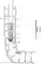 Fig. 72 - METHOD AND APPARATUS FOR MANIPULATING THE SIDE WALL OF A BODY LUMEN OR BODY CAVITY SO AS TO PROVIDE INCREASED VISUALIZATION OF THE SAME AND/OR INCREASED ACCESS TO THE SAME, AND/OR FOR STABILIZING INSTRUMENTS RELATIVE TO THE SAME