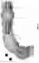 Fig. 74 - METHOD AND APPARATUS FOR MANIPULATING THE SIDE WALL OF A BODY LUMEN OR BODY CAVITY SO AS TO PROVIDE INCREASED VISUALIZATION OF THE SAME AND/OR INCREASED ACCESS TO THE SAME, AND/OR FOR STABILIZING INSTRUMENTS RELATIVE TO THE SAME