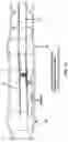 Fig. 79 - METHOD AND APPARATUS FOR MANIPULATING THE SIDE WALL OF A BODY LUMEN OR BODY CAVITY SO AS TO PROVIDE INCREASED VISUALIZATION OF THE SAME AND/OR INCREASED ACCESS TO THE SAME, AND/OR FOR STABILIZING INSTRUMENTS RELATIVE TO THE SAME