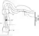 Fig. 83 - METHOD AND APPARATUS FOR MANIPULATING THE SIDE WALL OF A BODY LUMEN OR BODY CAVITY SO AS TO PROVIDE INCREASED VISUALIZATION OF THE SAME AND/OR INCREASED ACCESS TO THE SAME, AND/OR FOR STABILIZING INSTRUMENTS RELATIVE TO THE SAME