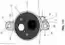 Fig. 86 - METHOD AND APPARATUS FOR MANIPULATING THE SIDE WALL OF A BODY LUMEN OR BODY CAVITY SO AS TO PROVIDE INCREASED VISUALIZATION OF THE SAME AND/OR INCREASED ACCESS TO THE SAME, AND/OR FOR STABILIZING INSTRUMENTS RELATIVE TO THE SAME