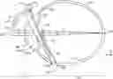 Fig. 01 - Prediction of post-operative vignetting in a pseudophakic eye