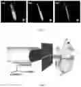 Fig. 03 - Devices and methods for photoacoustic tomography