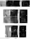 Fig. 06 - Devices and methods for photoacoustic tomography