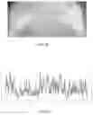 Fig. 06 - SYSTEM AND METHOD FOR EVALUATING VASCULAR HEALTH CONDITION OF A PERSON USING THERMAL IMAGING