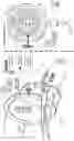 Fig. 06 - Method and apparatus for optically measuring blood pressure