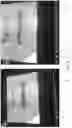 Fig. 07 - Methods and systems for continuous measurement of anomalies for dysmorphology analysis