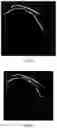 Fig. 10 - SIMPLIFIED METHOD, APPARATUS AND SYSTEM FOR MEASURING CORONARY ARTERY VASCULAR EVALUATION PARAMETERS