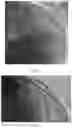 Fig. 07 - METHOD, APPARATUS AND SYSTEM FOR CONVENIENTLY MEASURING CORONARY ARTERY VASCULAR EVALUATION PARAMETERS