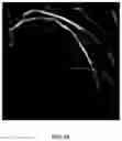 Fig. 10 - METHOD, APPARATUS AND SYSTEM FOR CONVENIENTLY MEASURING CORONARY ARTERY VASCULAR EVALUATION PARAMETERS