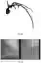 Fig. 12 - METHOD, APPARATUS AND SYSTEM FOR CONVENIENTLY MEASURING CORONARY ARTERY VASCULAR EVALUATION PARAMETERS