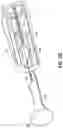 Fig. 09 - Vessel closure devices and methods