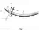Fig. 08 - Method and apparatus for passing suture through tissue