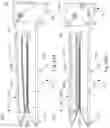 Fig. 35 - Linear surgical stapler