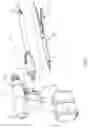 Fig. 02 - Mechanisms for compensating for drivetrain failure in powered surgical instruments