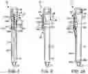 Fig. 02 - Enhanced Trocar