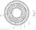 Fig. 06 - DETACHABLE-TIP BALLOON MICROCATHETER FOR EMBOLIZATION OF VASCULAR PATHOLOGY