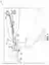 Fig. 02 - Knee arthroplasty validation and gap balancing instrumentation