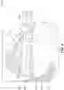 Fig. 05 - Knee arthroplasty validation and gap balancing instrumentation