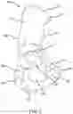 Fig. 03 - Methods and systems for bone mounted robotic-assisted hip and shoulder surgical systems