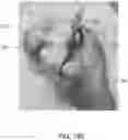 Fig. 13 - Methods and systems for bone mounted robotic-assisted hip and shoulder surgical systems