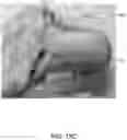 Fig. 14 - Methods and systems for bone mounted robotic-assisted hip and shoulder surgical systems