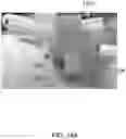 Fig. 17 - Methods and systems for bone mounted robotic-assisted hip and shoulder surgical systems