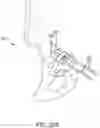 Fig. 24 - Methods and systems for bone mounted robotic-assisted hip and shoulder surgical systems