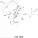 Fig. 25 - Methods and systems for bone mounted robotic-assisted hip and shoulder surgical systems