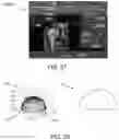 Fig. 30 - Methods and systems for bone mounted robotic-assisted hip and shoulder surgical systems