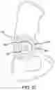 Fig. 35 - Methods and systems for bone mounted robotic-assisted hip and shoulder surgical systems