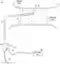 Fig. 01 - Lesion crossing shock wave catheter