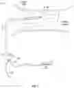Fig. 02 - Lesion crossing shock wave catheter