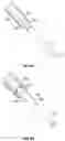 Fig. 11 - Lesion crossing shock wave catheter