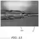 Fig. 11 - Systems and methods for intravascular obstruction removal