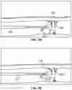 Fig. 06 - CELLULITE TREATMENT SYSTEM AND METHODS