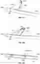 Fig. 40 - CELLULITE TREATMENT SYSTEM AND METHODS