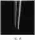 Fig. 07 - NEEDLE FOR TRANSCUTANEOUS ANALYTE SENSOR DELIVERY