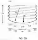Fig. 06 - Set screw and set screw driving tool for improved rod alignment