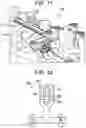 Fig. 07 - CONNECTORS FOR USE IN SYSTEMS AND METHODS FOR REDUCING THE RISK OF PROXIMAL JUNCTIONAL KYPHOSIS