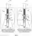 Fig. 04 - Bone fixation tangs with self-balancing extension