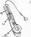 Fig. 02 - Extramedullary internal bone lengthening and fixation device with dynamic axial stabilization