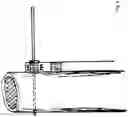 Fig. 04 - Extramedullary internal bone lengthening and fixation device with dynamic axial stabilization