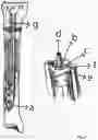 Fig. 06 - Extramedullary internal bone lengthening and fixation device with dynamic axial stabilization