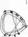 Fig. 09 - Extramedullary internal bone lengthening and fixation device with dynamic axial stabilization