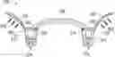 Fig. 01 - APPARATUS AND METHOD OF AN OSTEOTOMY FOR DENTAL IMPLANT