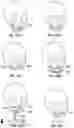 Fig. 19 - APPARATUS AND METHOD OF AN OSTEOTOMY FOR DENTAL IMPLANT