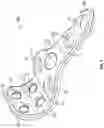 Fig. 02 - Extremity Fusion Plate Assembly
